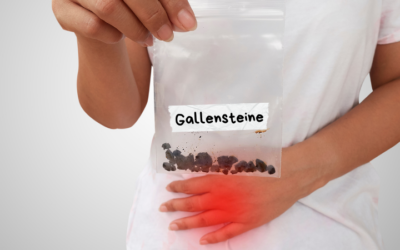 Gallensteine loswerden: Effektive Behandlung und Vorbeugung