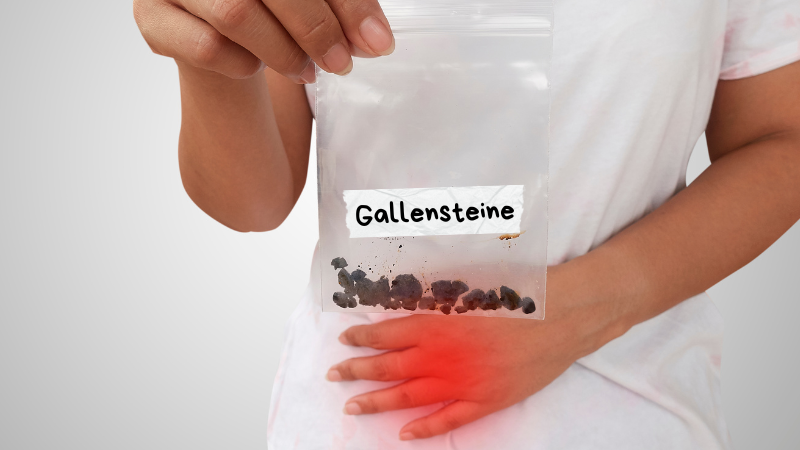 Gallensteine loswerden: Effektive Behandlung und Vorbeugung