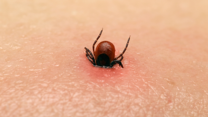 Zecken sind Blutsaugender - die Bissstelle ist bereits errötet.